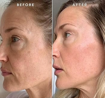 CitraVive Skin Booster Serum